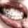 User Mirie, Profilbild, Avatar